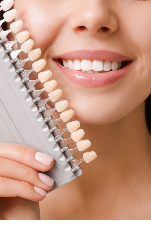 Carillas dentales en Barcelona, Dr. Cardona Soro