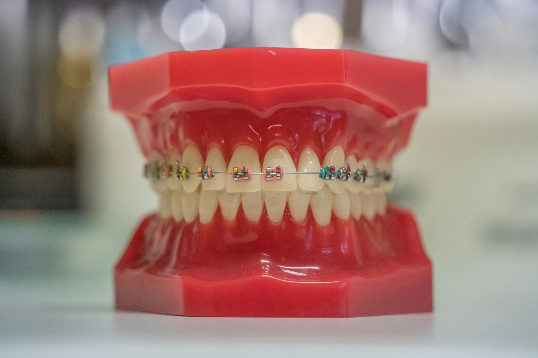 Modelo dental de encías rojas con brackets de colores en los dientes, sobre una mesa