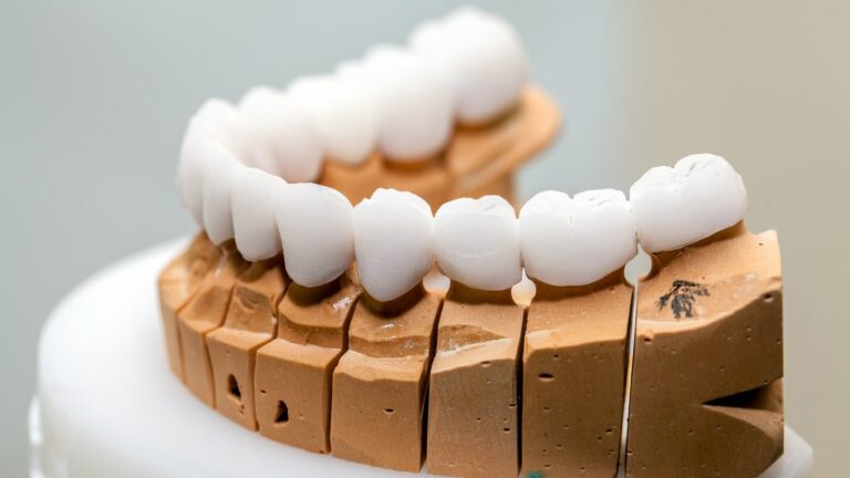 Carillas de zirconio en Barcelona