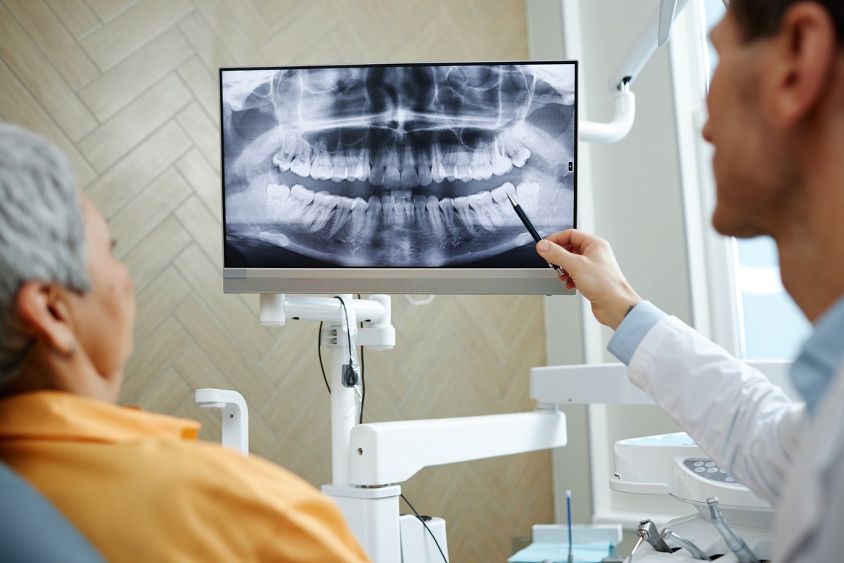 Radiografía dental en pantalla para valorar carillas en dientes con endodoncia
