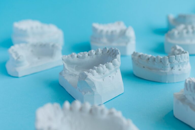Qué es el mock-up dental y por qué decide el resultado