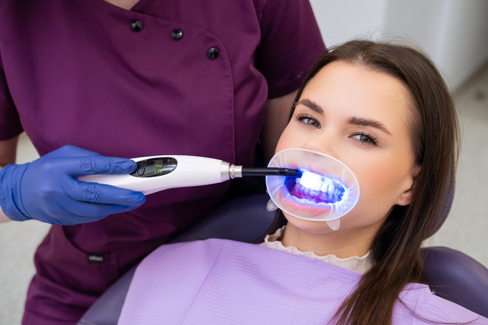 Lámpara de luz azul dirigida a los dientes de una paciente con separador de labios en la consulta