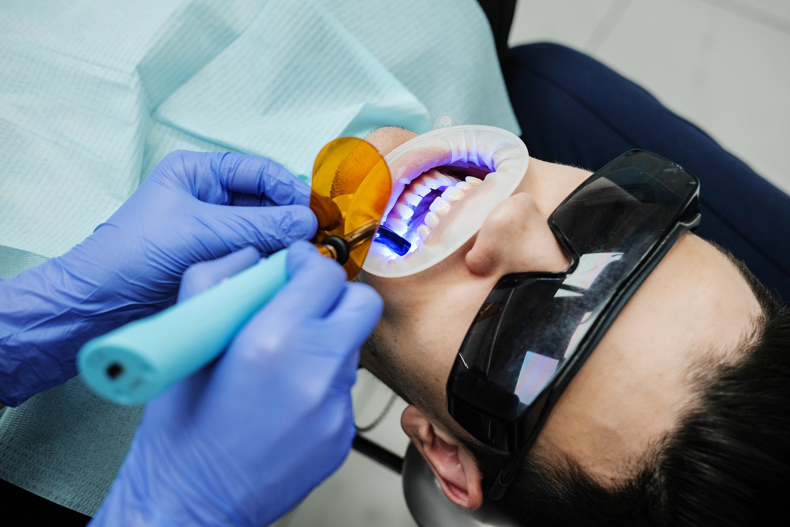 Dentista aplicando luz azul de polimerizar sobre los dientes delanteros de un paciente con gafas protectoras