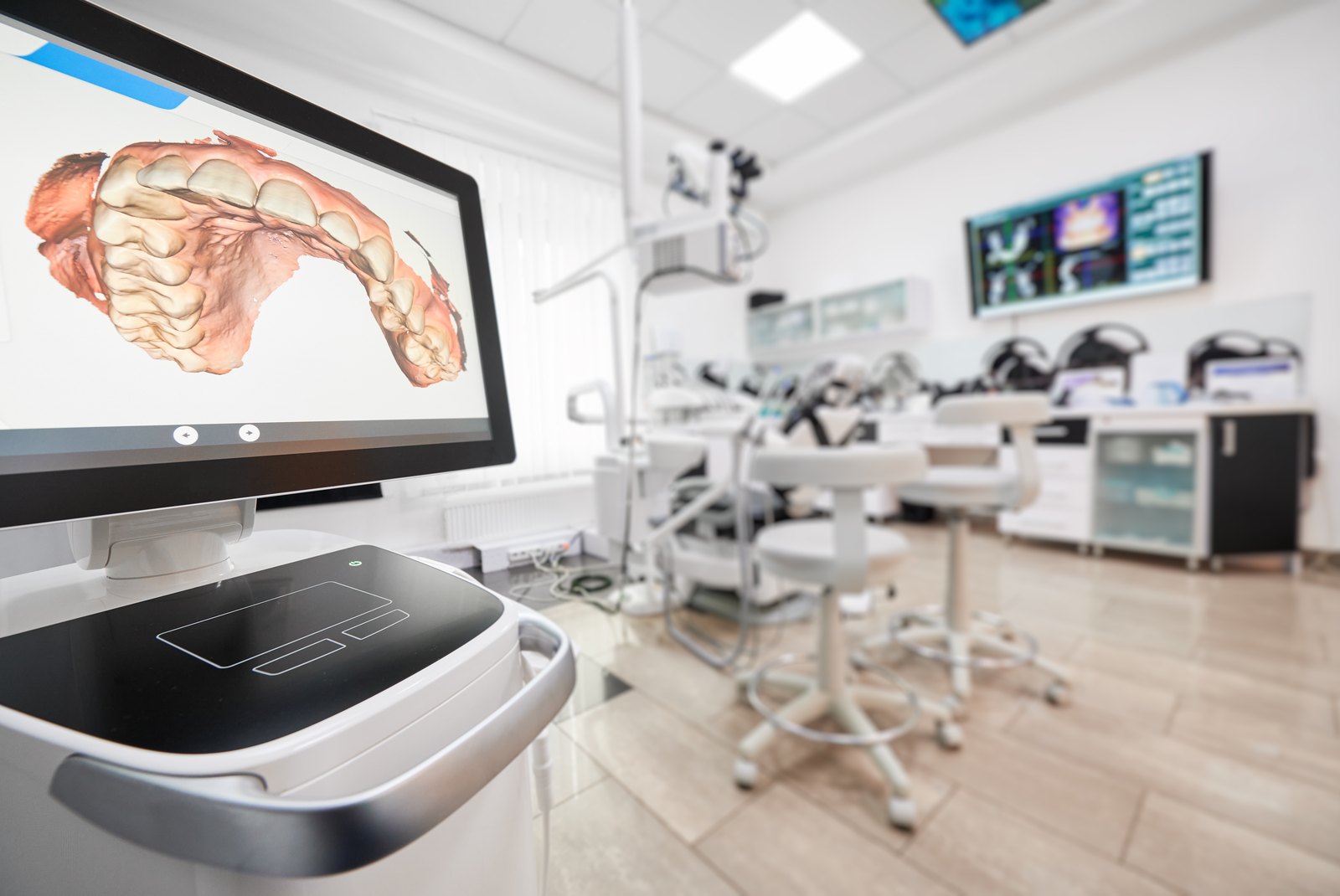 Pantalla de un escáner intraoral con la arcada dental escaneada en una consulta moderna