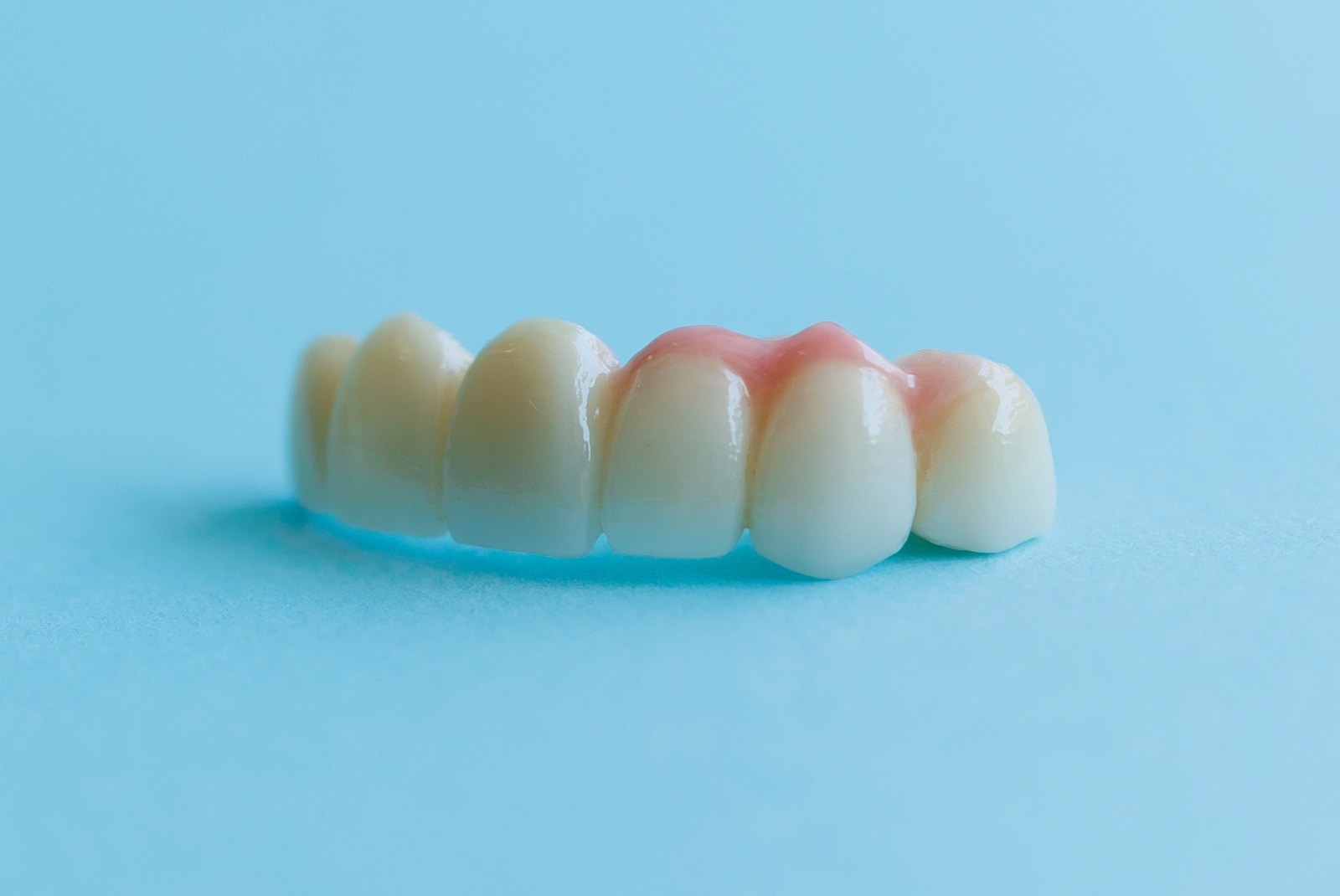 Puente dental de porcelana con varias coronas y encía rosada sobre un fondo azul